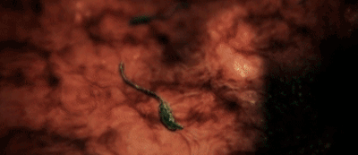 头皮发麻|看到隐藏在人体内的虫子，我感受到了头皮发麻