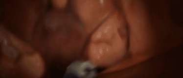 头皮发麻|看到隐藏在人体内的虫子，我感受到了头皮发麻