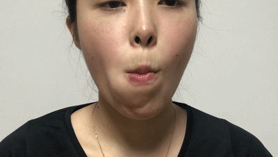 为了您的健康我们专家有话说甩掉面具脸不做冰美人