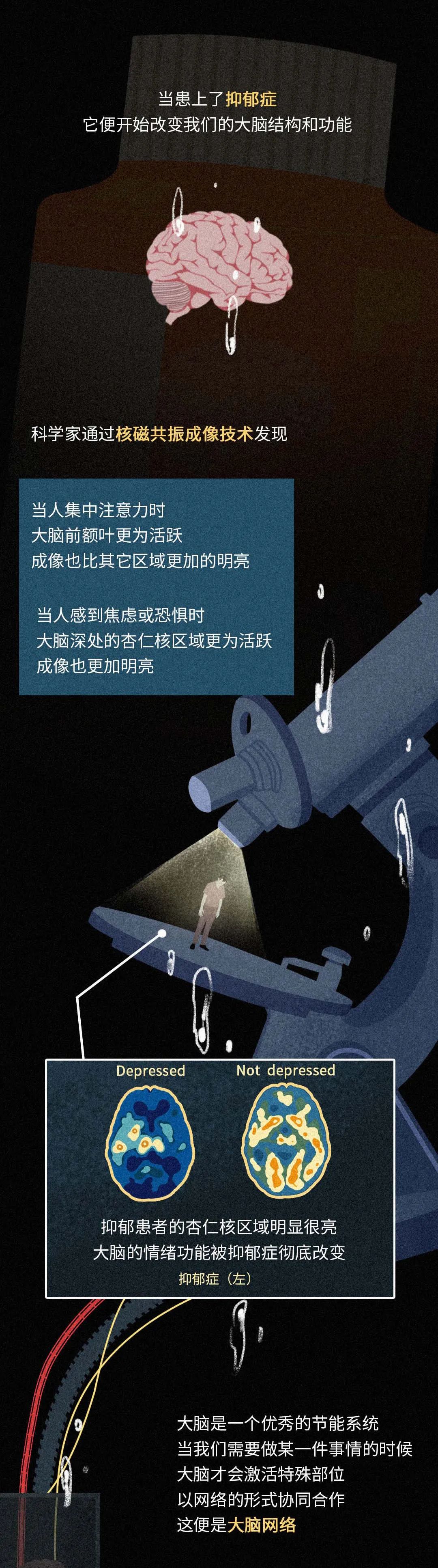 抑郁症|【心理健康】抑郁症对我们的大脑做了什么？