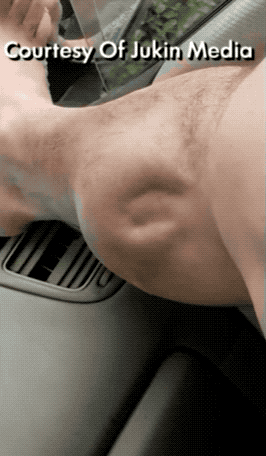 肌肉|网红猛男的跳舞肌肉引发围观，但他其实患上了罕见病