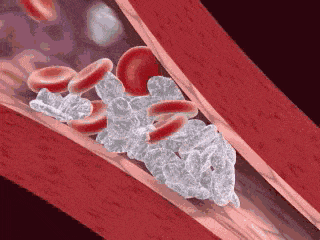 耽误高血压治疗的5大误区这些习惯才能帮你控制血压健康日历