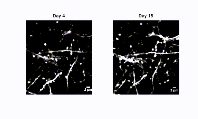大脑|人类为什么这么聪明？大脑神经纤维总长度能绕地球四周半