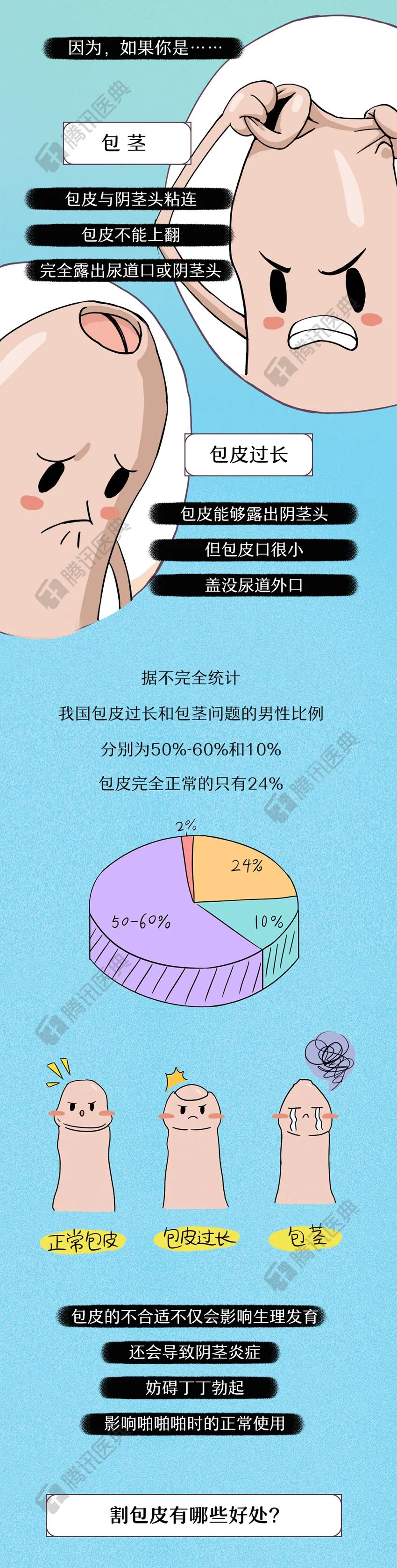 三千年前就有人做了包皮手术割包皮的2大好处你肯定不知道