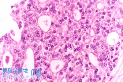 前列腺癌|权威机构报道：国际研究确定了晚期前列腺癌患者可能使用的新型联合化疗！