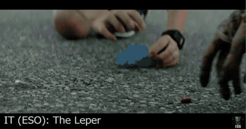 马凡氏综合征|因为基因突变他长成了网文男主的样子，但却因此只适合出演恐怖片