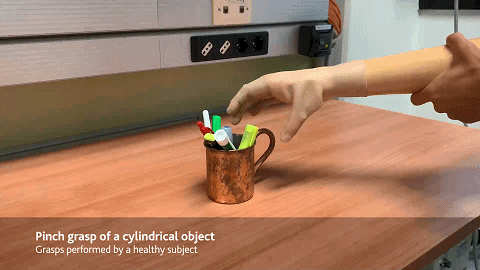 仿生手|真正的仿生手来了，可恢复截肢者90％以上功能