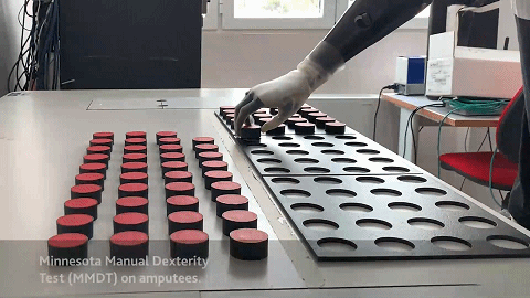 仿生手|真正的仿生手来了，可恢复截肢者90％以上功能