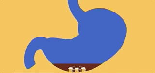 喝进去水尿出来酒膀胱装酒的怪病99的医生都没见过