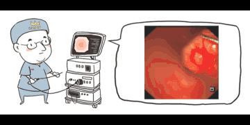 食管|罕见！59岁余姚大伯食管里长了巨大瘤，又出现魔鬼般并发症，还好……