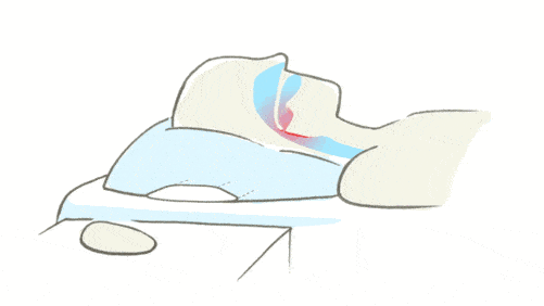 睡眠监测是什么 哪些人群需要做睡眠监测 腾讯新闻