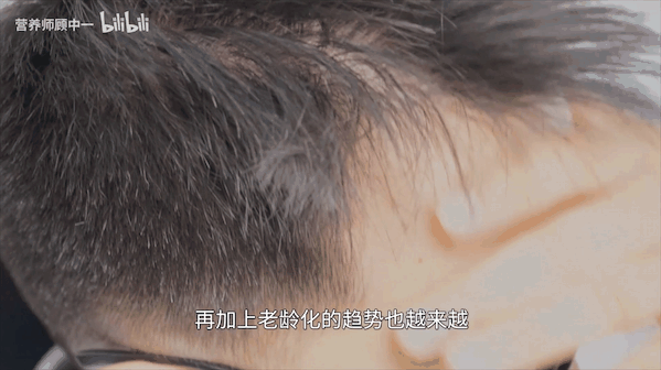 脱发|“掉头发”几根算正常？吃啥能补？