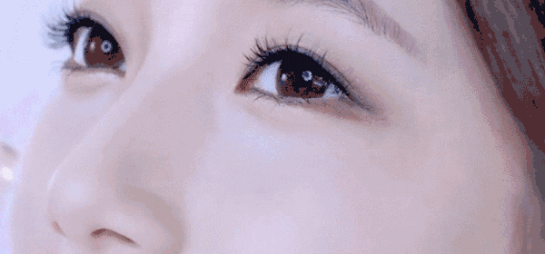 由于双眼皮设计过宽,缝合时过高超过睑板宽度,或手术