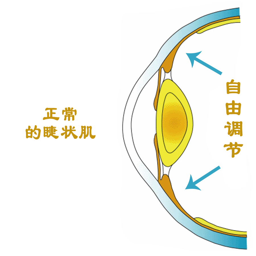 无论用什么方法矫正,视力必须提高,否则无效,如果视力不能提高就不要