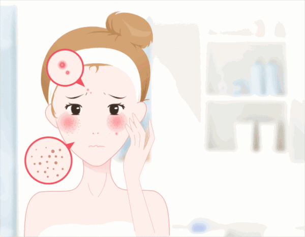 如果自己是敏感肌怎么办敏感肌肤用什么护肤品好