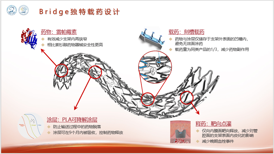 微創神通椎動脈藥物支架獲批上市