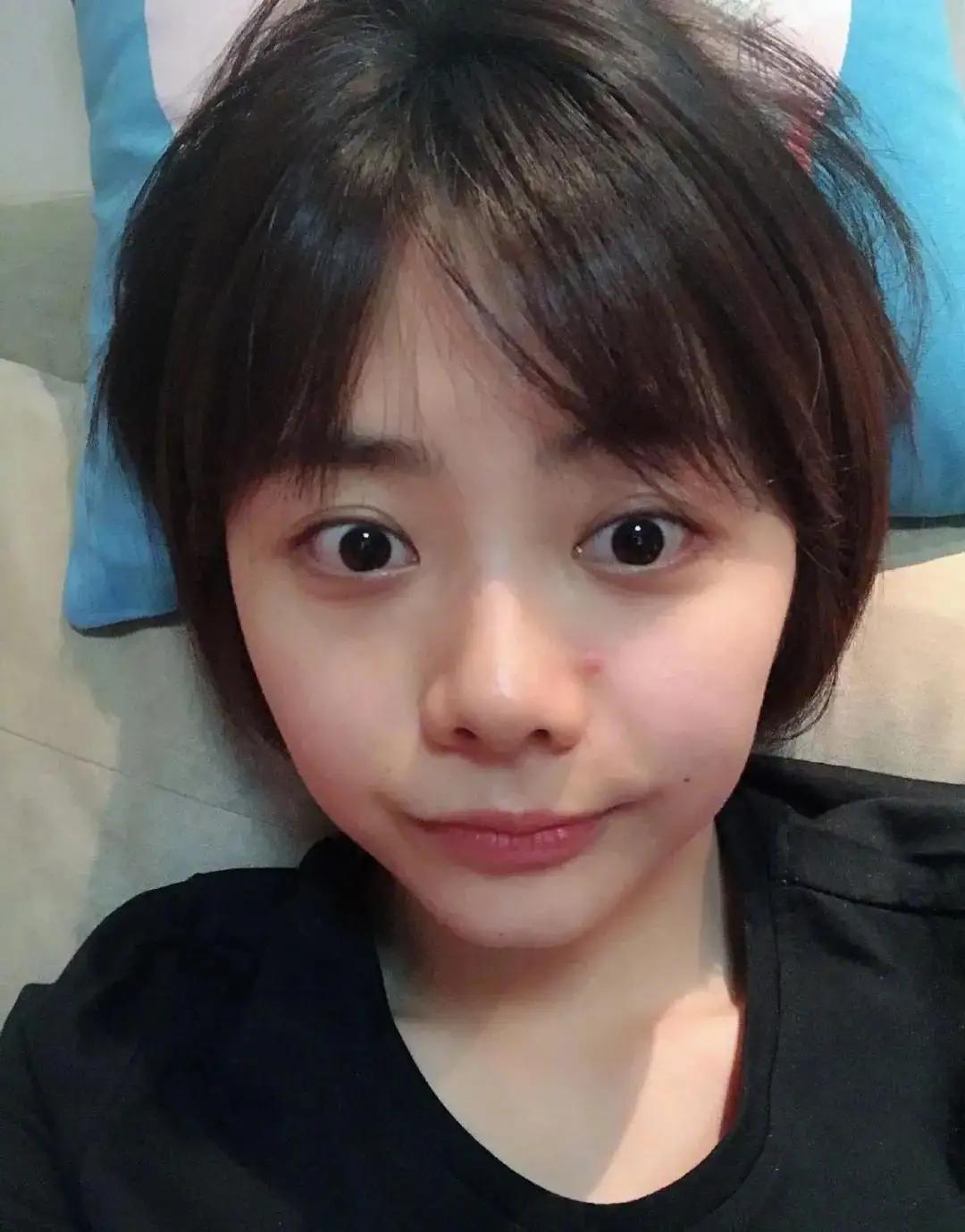 扛住央视镜头的谭松韵,却扛不过一颗痘痘,痘痘这东西到底怎么灭