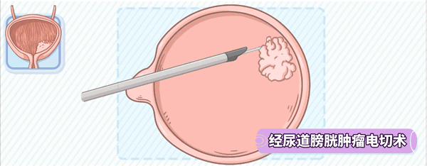 600_234gif 动态图 动图