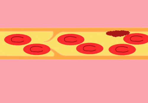 颈动脉窦|脖子上“种草莓”真的有可能致命？恩爱有风险，下口需谨慎