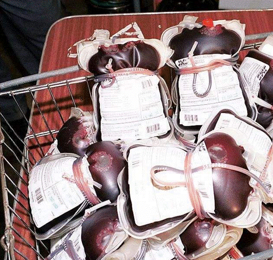 彼得·蒂尔|富豪彼得·蒂尔一年换血4次，换血延长寿命，他变成了吸血鬼？