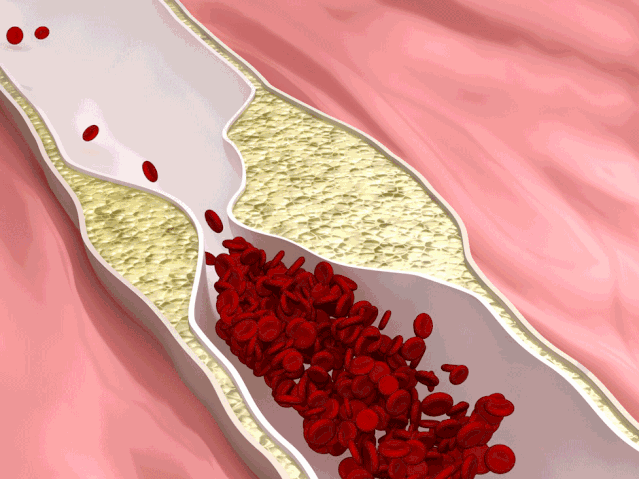 不饱和脂肪酸|中国人油吃得太多了，真的很危险