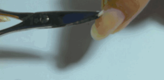 邓萃雯|【吓人】香港演员邓萃雯拔倒刺入院！这种错误，你肯定也常犯！