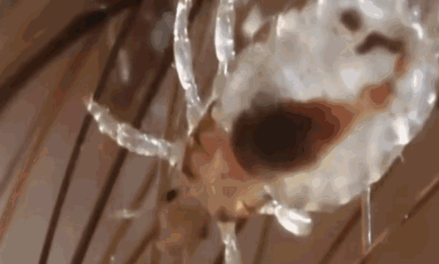 虱子|明明很干净，为什么还会长虱子？什么样的人容易感染虱子？