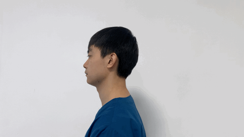 颈椎|体检查出“颈椎曲度变直”是什么意思？是手机玩太多的锅吗？