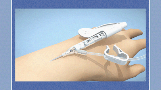 护理红宝书|守护生命,急诊护航——留置针选择篇