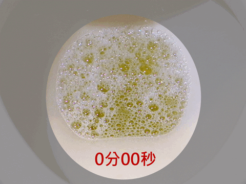 泡沫尿|泡沫尿，就是蛋白尿，就是肾功不全吗？医生辟谣，讲清楚诸多因素