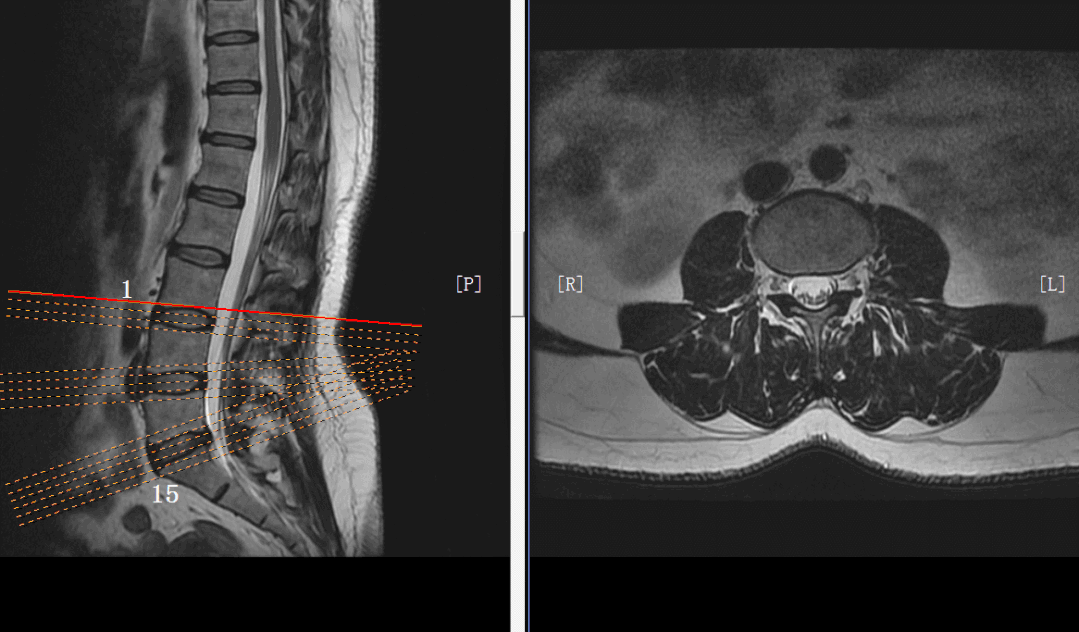 mri摆位,我不信你真的会!