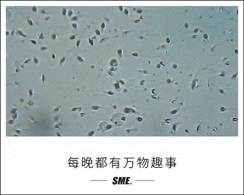 腮腺炎|男孩小时候得过腮腺炎，成年后有可能无法生育？