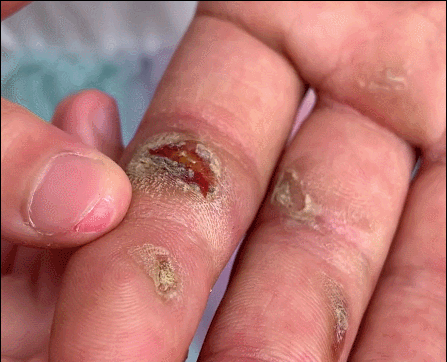 被磨破的手掌小女孩发现了消防员互动时并送上她亲手制作的小粽子看望