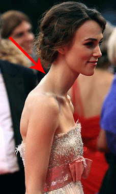 脖子前倾,也叫探颈,猥琐颈.