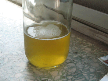 人排出去的尿液,到底是"脏"还是"香"?如果喝下去有好处吗?