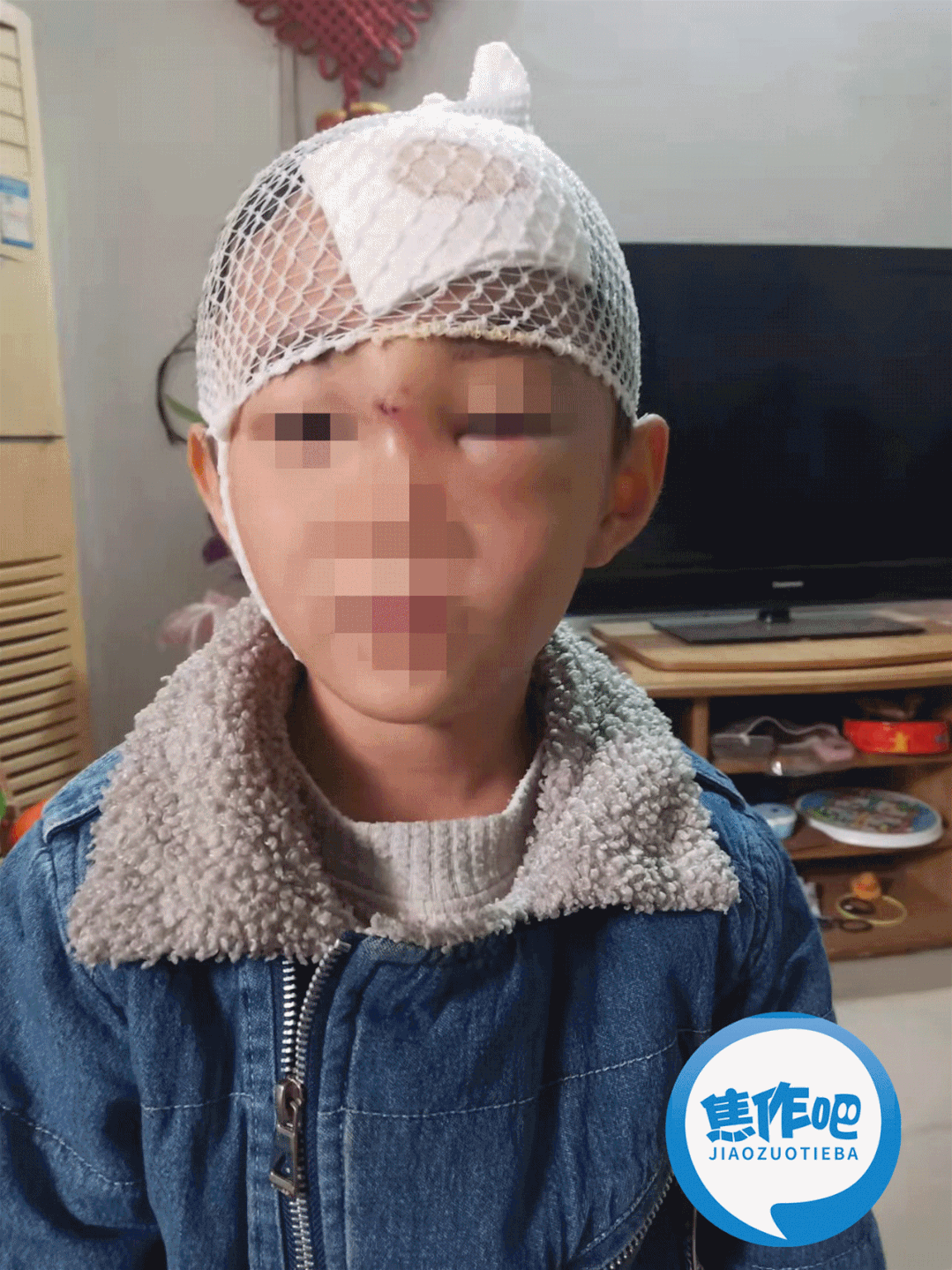 城事破路伤人焦作母子三人被坑俩孩子头破血流鼻青脸肿太惨了
