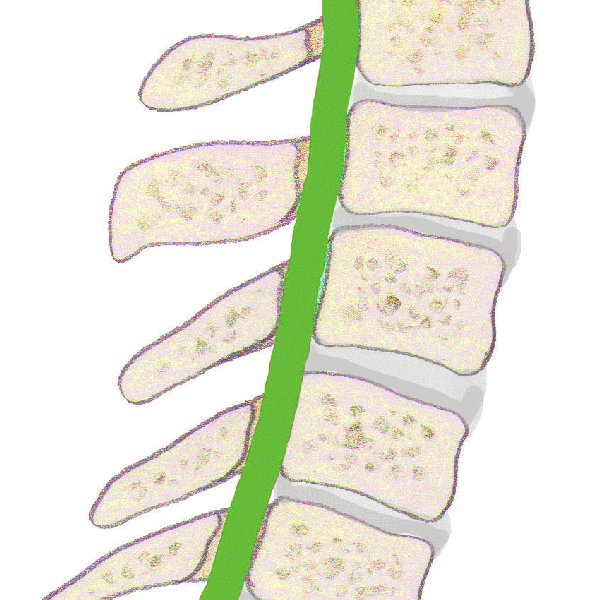 你的颈椎还好吗?不妨来测试一下