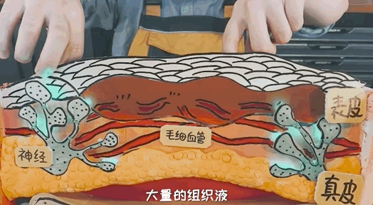 大量的组织液从破损处渗出像针扎一样的疼痛伴随着持续发生了破损组织