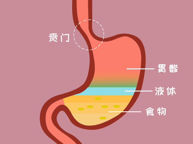 与传统手术比较,内镜下治疗不仅疗效相当,而且创伤小,并发症少,费用