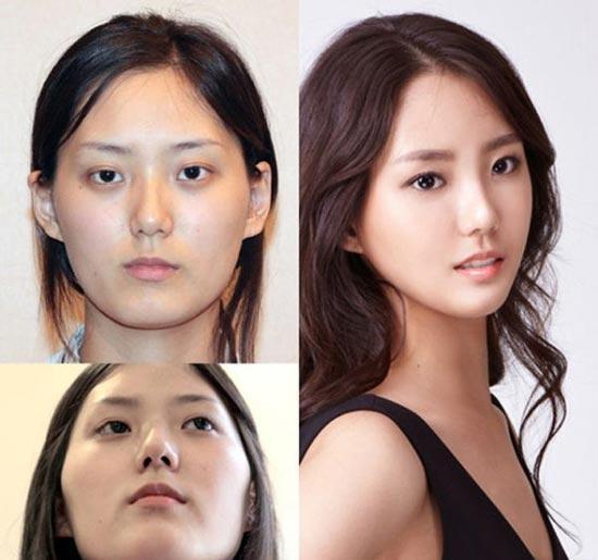 韩国人造美女整容对比照 完胜ps