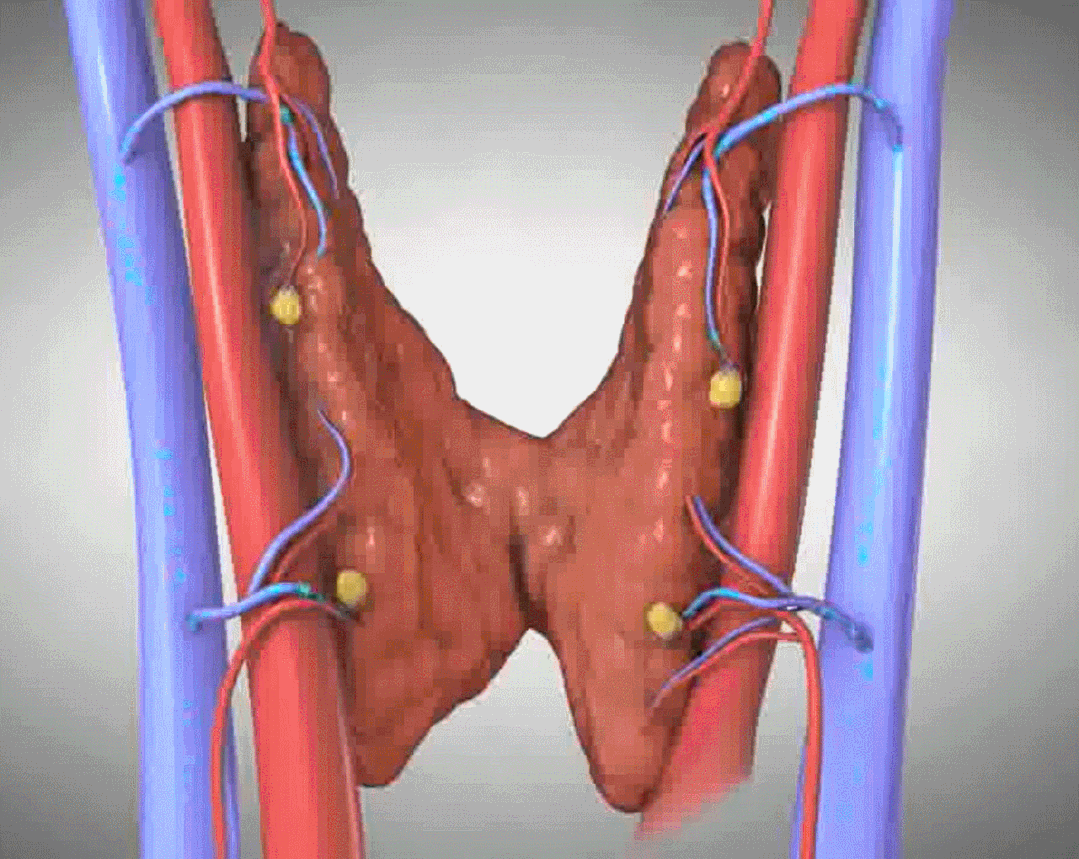 爱生气的女人更容易得甲状腺结节吗