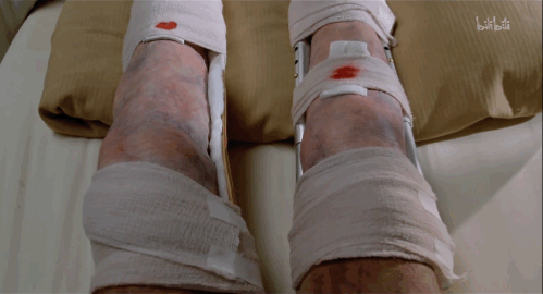 因为大雪封路,安妮没法送他去医院,只好将他带到这里,她帮他接了脱臼