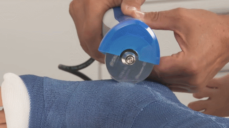 电动石膏锯是怎么只锯石膏不锯肉的呢