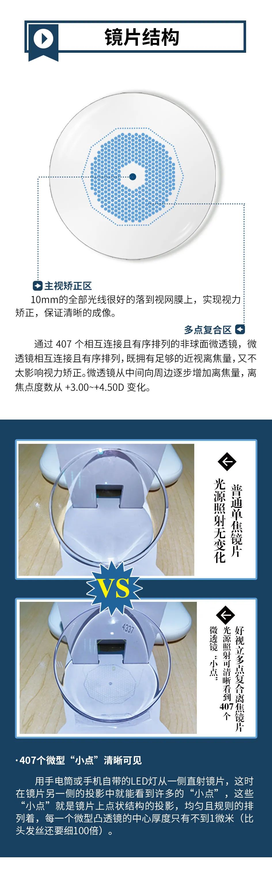 好视立多点复合离焦镜:预防近视新突破,超乎想象"镜"不同!_腾讯新闻
