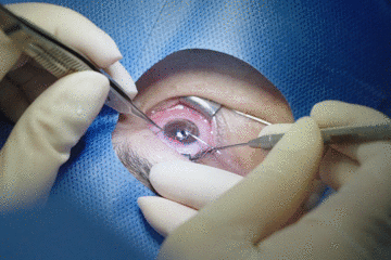 想做手术,看完再决定_腾讯新闻