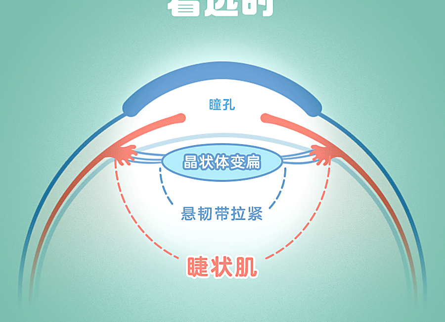 处于持续收缩的状态,眼睛得不到调整跟缓解,就容易出现睫状肌痉挛