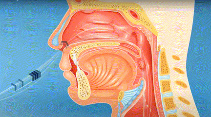 正常的呼吸功能是气流通过鼻腔通道,以鼻呼吸的方式进行.