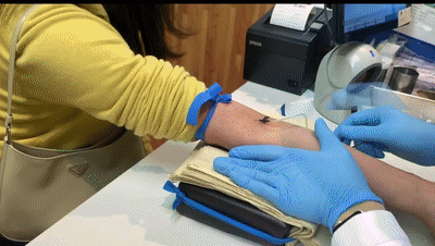 95后护士"飞针"采血,绝了!