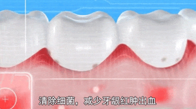 接吻时，发现对象口臭怎么办？17