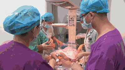 首例联体婴儿分离手术这是闽西南地区成功"分离"厦门市妇幼保健院在